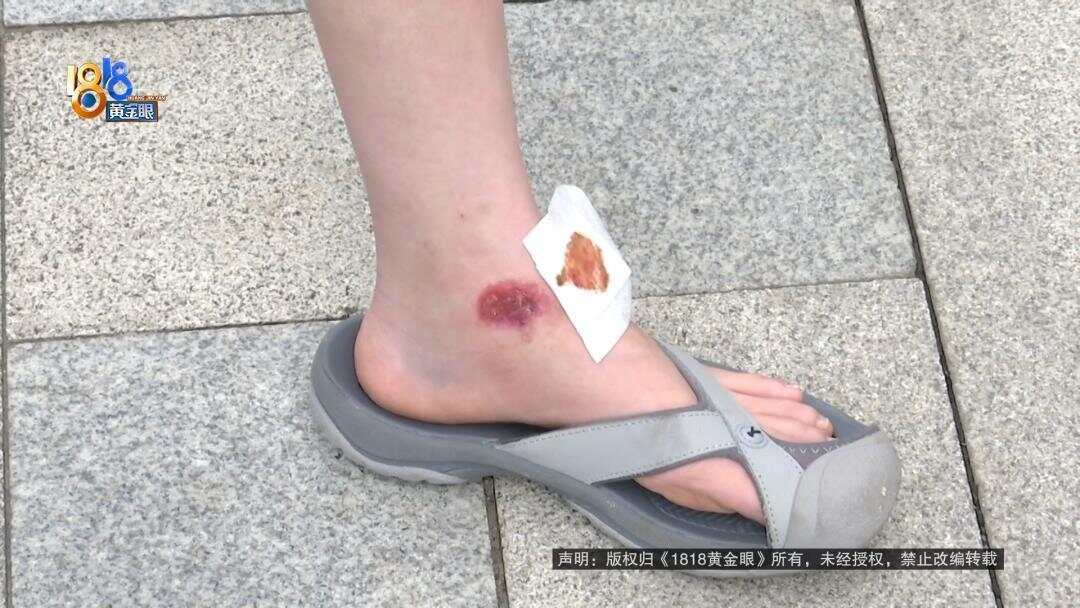 女子下班回家被外卖骑手撞伤 外卖小哥:我只有三块钱